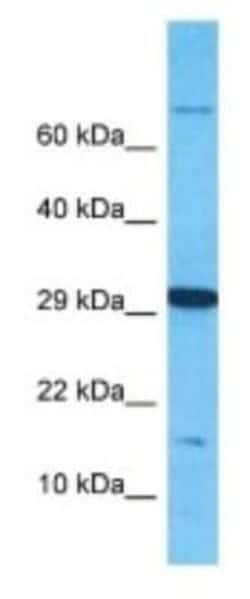 OBP2B Rabbit anti-Human, Polyclonal, Novus Biologicals 100 &mu;g; Unconjugated:Antibodies,